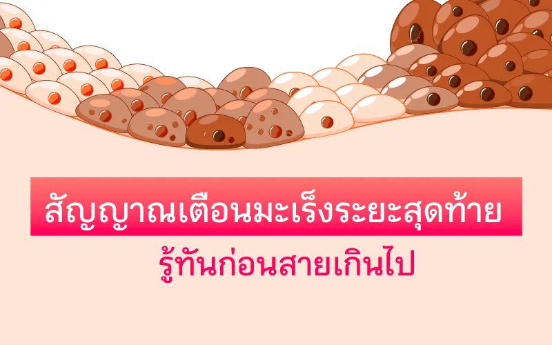 สัญญาณเตือน! มะเร็งระยะสุดท้าย รู้ทันก่อนสายเกินไป